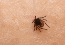 Flåtbid kan give farlige infektioner